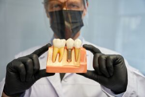 Wszystko co musisz wiedziec przed zabiegiem implantacji